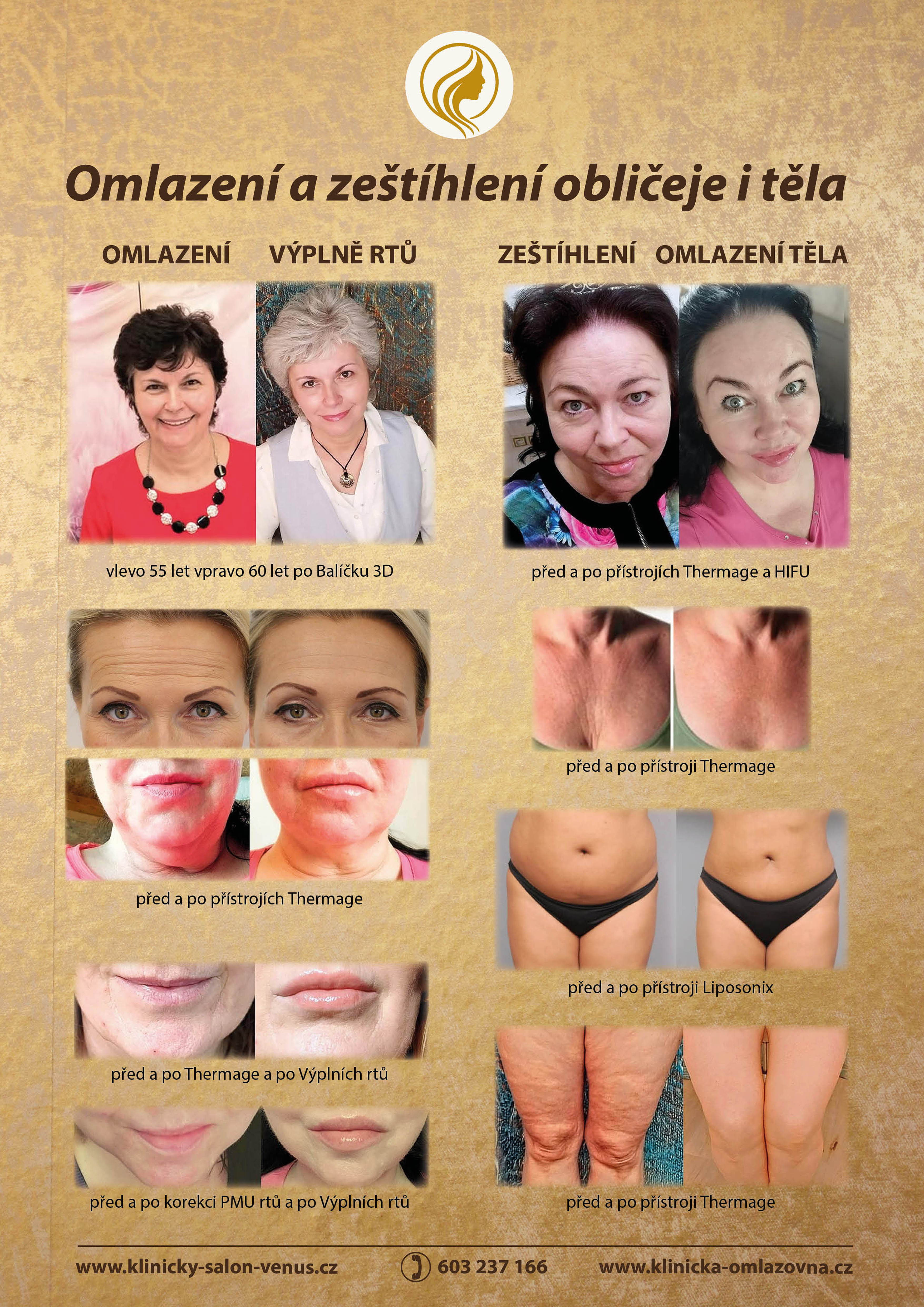 plakát_ 841 x 1189_10_2025_piktogram.jpg